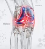 Anatomical_human_knee_inflammati…_2K_202607111731